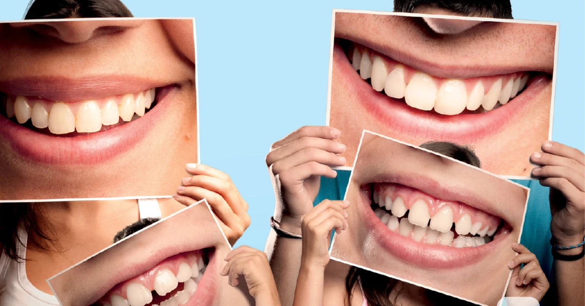 Karies in slab ustni zadah